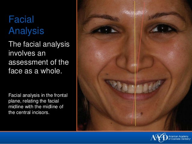 Spunk mouth leili Facial mid line